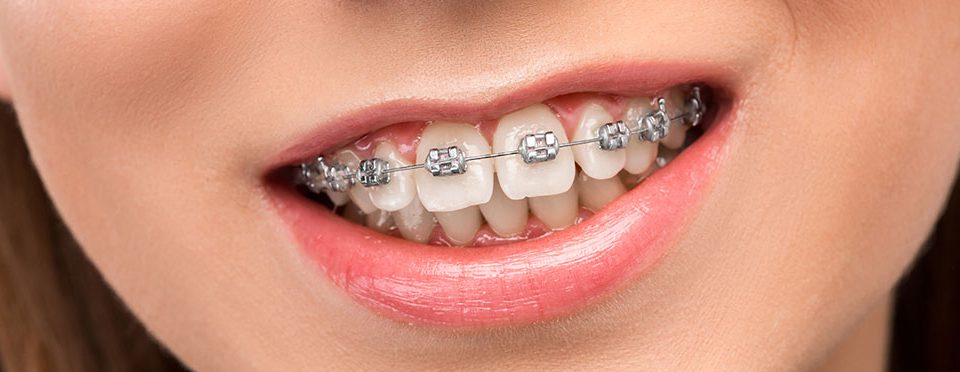 dis-teli-tedavisi-uskudar