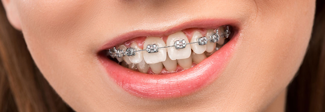 dis-teli-tedavisi-uskudar